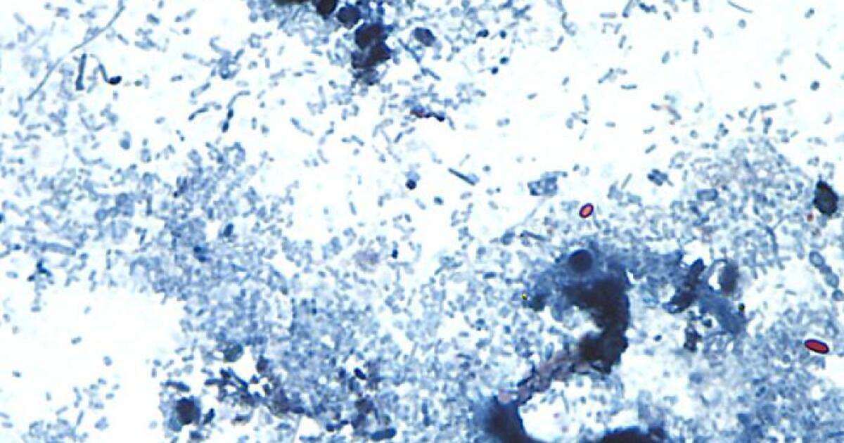 CDC szakértőket küld Ohióba a ciklosporázis járványkitörés vizsgálatára